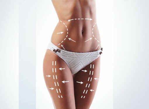 Bring Back Your Shape With Liposuction - Boca Raton