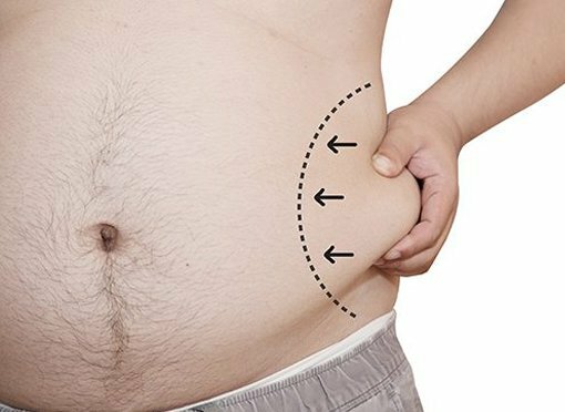Liposuction For Men - Bring Out Muscle Tone - Boca Raton Surgeon